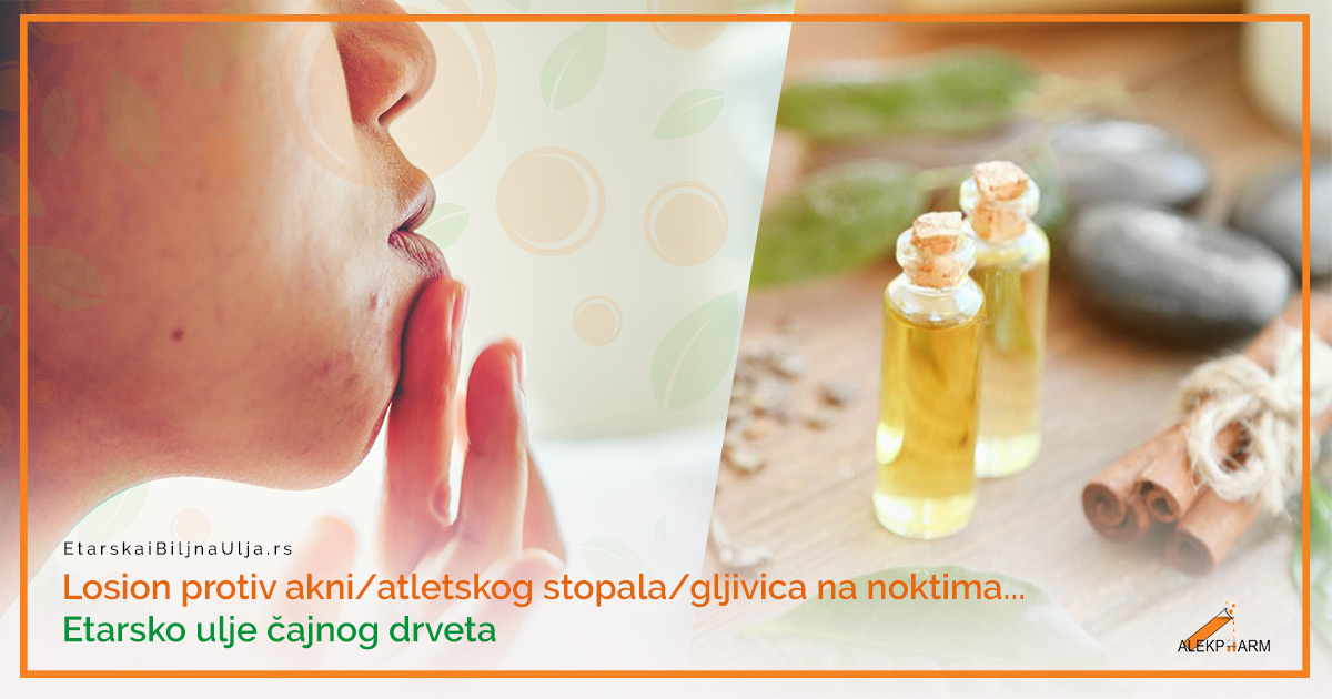 RADOZNALOST JE UBILA MAČKU RADOZNALOST JE UBILA MAČKU